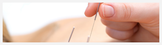 Acupuncture